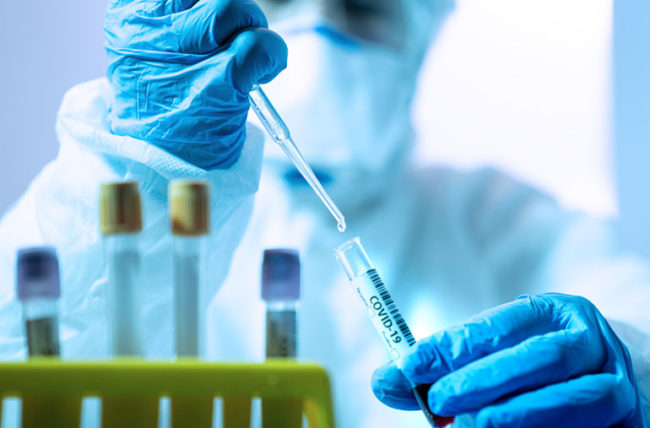 ओमिक्रॉन को कोरोना सैंपल से अलग करेंगे ICMR के वैज्ञानिक