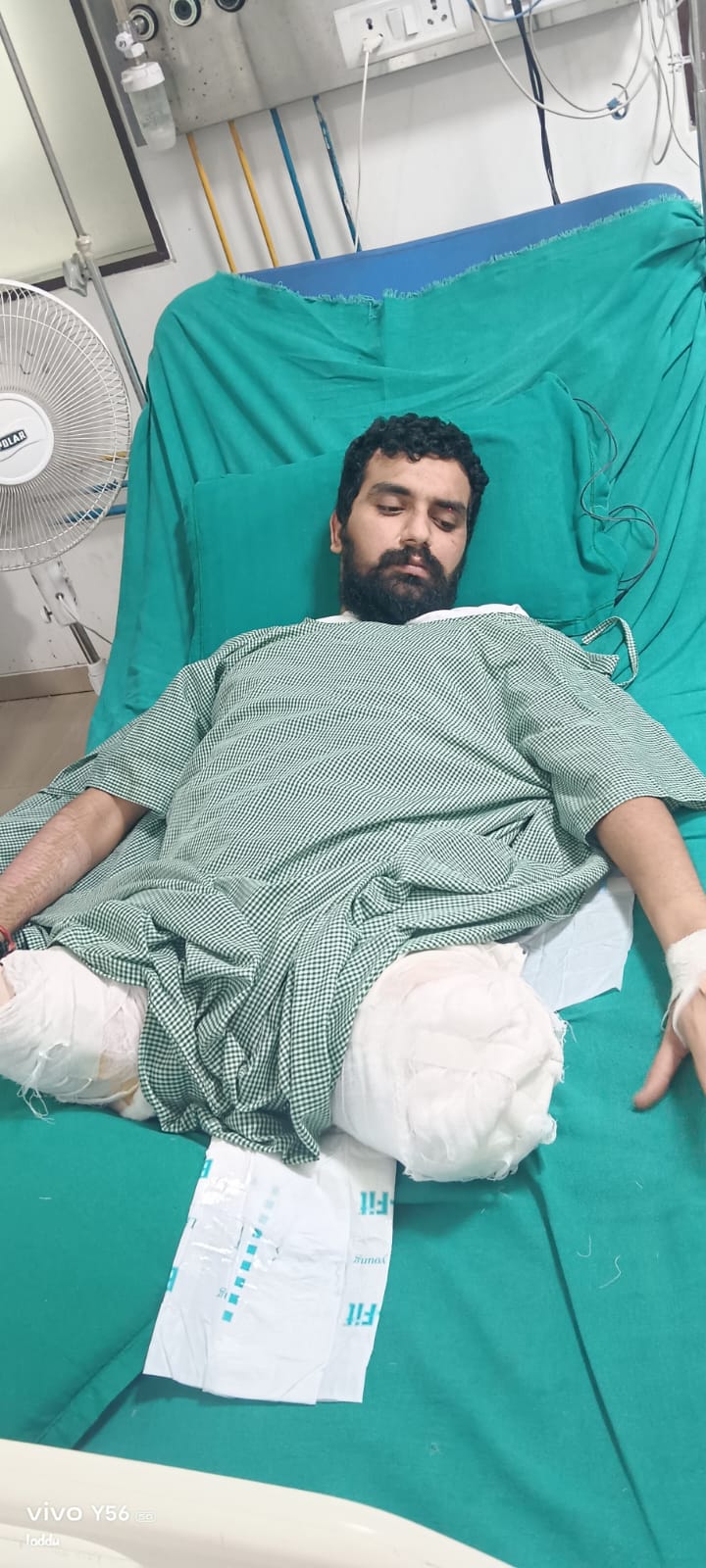 दुर्घटना में कट गये थे दोनों पांव, फिर भी बचा ली जान